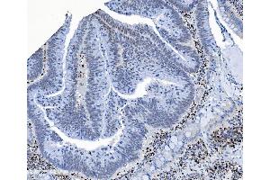 IHC analysis of SAMHD1 using anti-SAMHD1 antibody (ABIN7601515).