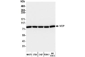 Western Blotting (WB) image for anti-Valosin Containing Protein (VCP) (C-Term) antibody (ABIN7452151)