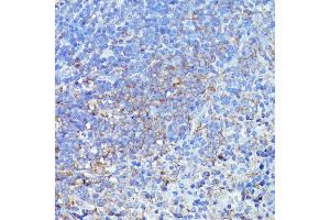 Immunohistochemistry (IHC) image for anti-Septin 1 (SEPT1) (AA 270-370) antibody (ABIN7270202)