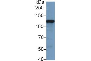 Western Blot; Sample: Human HepG2 cell lysate; Primary Ab: 1µg/ml Rabbit Anti-Human HK2 Antibody Second Ab: 0. (Hexokinase 2 Antikörper  (AA 619-917))