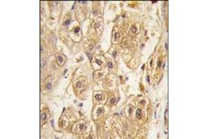Image no. 2 for anti-Platelet Derived Growth Factor Receptor beta (PDGFRB) antibody (ABIN359922) (PDGFRB Antikörper)