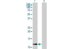 Western Blot analysis of RAB42 expression in transfected 293T cell line by RAB42 MaxPab polyclonal antibody. (RAB42 Antikörper  (AA 1-105))