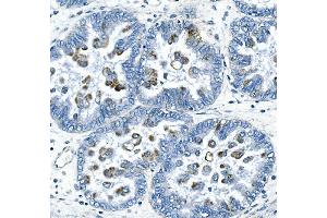 IHC analysis of CCNB2 using anti-CCNB2 antibody (ABIN7600750).