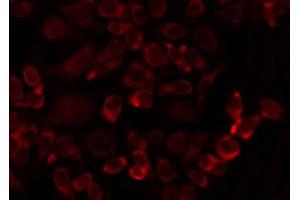 ABIN6274737 staining HuvEc by IF/ICC. (MRPL24 Antikörper  (Internal Region))