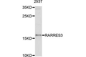 Western blot analysis of extracts of 293T cells, using RARRES3 antibody.