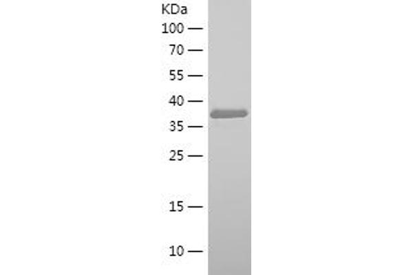 Neuregulin 1 Protein (NRG1) (AA 119-237) (His-IF2DI Tag)