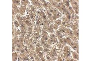 Immunohistochemistry of erbB-2 in human liver tissue with erbB-2 antibody at 2.
