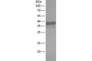 Calretinin Protein (AA 1-159) (His-IF2DI Tag)