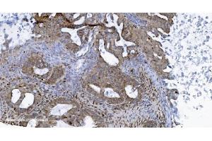 IHC analysis of SAMHD1 using anti-SAMHD1 antibody (ABIN7601514). (SAMHD1 Antikörper  (AA 37-626))