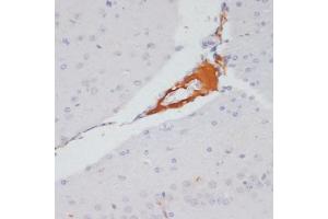Immunohistochemistry of paraffin-embedded mouse brain using Phospho-ACLY-S455 antibody (ABIN6135178, ABIN6136002, ABIN6136003 and ABIN6225678) at dilution of 1:100 (40x lens). (ACLY Antikörper  (pSer455))