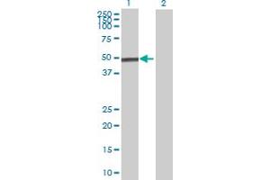 Lane 1: MICB transfected lysate ( 37. (MICB 293T Cell Transient Overexpression Lysate(Denatured))