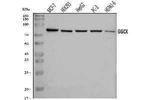 Western blot analysis of GGCX using anti-GGCX antibody (ABIN7602419).
