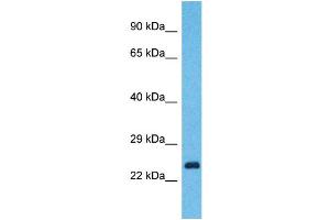Western Blotting (WB) image for anti-Yip1 Domain Family, Member 7 (YIPF7) (N-Term) antibody (ABIN2791993) (YIPF7 Antikörper  (N-Term))