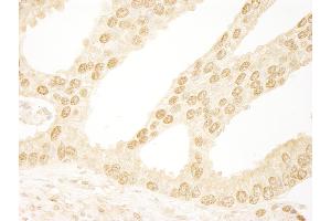 anti-Integrator Complex Subunit 6 (INTS6) (AA 750-800) antibody