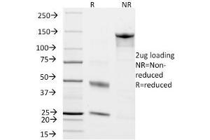 SDS-PAGE Analysis Purified Chromogranin A Monoclonal Antibody (CHGA/798).