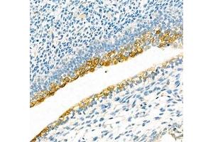Immunohistochemistry of paraffin embedded mouse embryonic mouse using IFIT5 (ABIN7074334) at dilution of 1:300 (300x lens) (IFIT5 Antikörper)