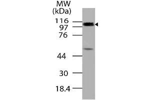 Image no. 1 for anti-Cylindromatosis (Turban Tumor Syndrome) (CYLD) (AA 1-230) antibody (ABIN5027127) (CYLD Antikörper  (AA 1-230))