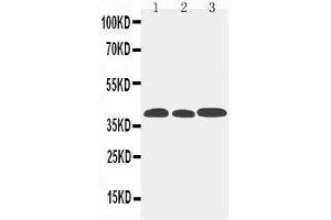 Anti-CCR5 antibody,  Western blotting Lane 1: Mouse Lung Tissue Lysate Lane 2: Mouse Intestine Tissue Lysate Lane 3: Mouse Kidney Tissue Lysate (CCR5 Antikörper  (N-Term))
