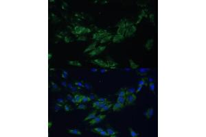 Immunofluorescence analysis of C6 cells using EPH antibody (ABIN6132064, ABIN6140215, ABIN6140216 and ABIN6224369) at dilution of 1:100. (EPH Receptor A4 Antikörper  (AA 887-986))