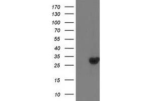 Western Blotting (WB) image for anti-Deoxythymidylate Kinase (Thymidylate Kinase) (DTYMK) antibody (ABIN1497919) (DTYMK Antikörper)