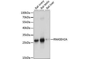Western blot analysis of extracts of various cell lines, using RNASEH2A antibody. (RNASEH2A Antikörper)