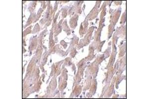 Immunohistochemistry (IHC) image for anti-Myeloid Differentiation Primary Response Gene (88) (MYD88) (AA 176-280) antibody (ABIN492527) (MYD88 Antikörper  (AA 176-280))