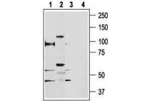 Western blot analysis of rat kidney (lanes 1 and 3) and human PC3 prostate cancer cell line (lanes 2 and 4) lysates: - 1,2. (TRPV5 Antikörper  (C-Term, Intracellular))