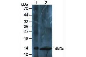 Western blot analysis of (1) Mouse Liver Tissue and (2) Mouse Spinal Cord Tissue. (Osteocalcin Antikörper  (AA 14-95))