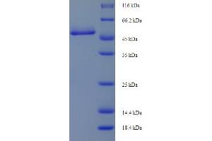 SDS-PAGE (SDS) image for Cathepsin D (CTSD) (AA 65-408), (partial) protein (His-SUMO Tag) (ABIN5709355) (Cathepsin D Protein (CTSD) (AA 65-408, partial) (His-SUMO Tag))