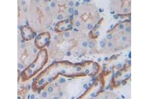 Used in DAB staining on fromalin fixed paraffin- embedded Kidney tissue (JAM3 Antikörper  (AA 30-241))