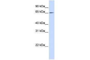 NET1 antibody used at 1 ug/ml to detect target protein.