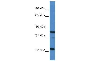Western Blot showing SFRS2 antibody used at a concentration of 1 ug/ml against Hela Cell Lysate (SRSF2 Antikörper  (C-Term))