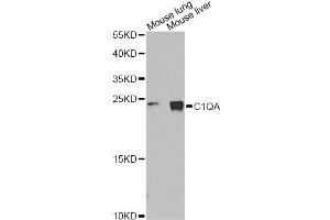 Western blot analysis of extracts of various cell lines, using C1QA Antibody (ABIN1875415) at 1:1000 dilution. (C1QA Antikörper)
