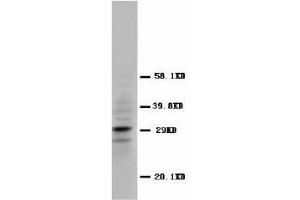 Image no. 2 for anti-Calbindin 2 (CALB2) (N-Term) antibody (ABIN1495049) (Calretinin Antikörper  (N-Term))
