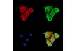 ABIN6263023 and ABIN6277536 staining Hela cells by IF/ICC.