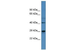 Western Blotting (WB) image for anti-Carbonic Anhydrase II (CA2) (C-Term) antibody (ABIN2788328) (CA2 Antikörper  (C-Term))
