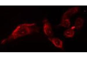 ABIN6279907 staining  Hela cells by IF/ICC. (OTUB1 Antikörper  (Internal Region))