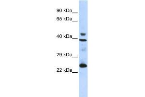 WB Suggested Anti-SEPP1 Antibody Titration: 0. (Selenoprotein P Antikörper  (N-Term))
