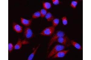 IF analysis of CP110 using anti-CP110 antibody (ABIN5693312).