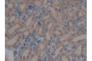 DAB staining on IHC-P; Samples: Rat Kidney Tissue (GALNS Antikörper  (AA 172-381))