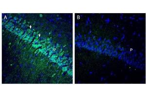 Expression of OCTN1 in rat hippocampus. (SLC22A4 Antikörper  (C-Term, Intracellular))