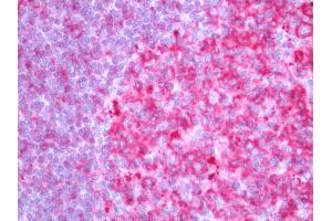 Immunohistochemistry (Paraffin-embedded Sections) (IHC (p)) image for anti-Major Histocompatibility Complex, Class II, DR beta 1 (HLA-DRB1) antibody (FITC) (ABIN2606320)