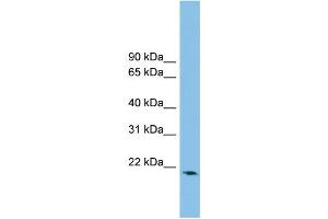 WB Suggested Anti-RHOB Antibody Titration: 0.