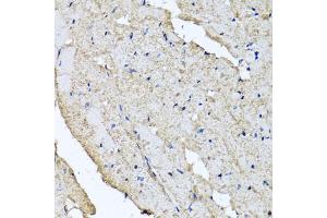 Immunohistochemistry of paraffin-embedded rat heart using USH1C antibody (ABIN5972448) at dilution of 1/100 (40x lens). (USH1C Antikörper)