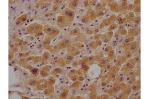 IHC image of ABIN7153713 diluted at 1:100 and staining in paraffin-embedded human liver tissue performed on a Leica BondTM system. (Glucose-6-Phosphate Dehydrogenase Antikörper  (AA 422-712))