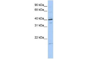 WB Suggested Anti-TPPP3 Antibody Titration:  0.