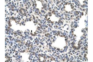 BCHE antibody was used for immunohistochemistry at a concentration of 4-8 ug/ml to stain Alveolar cells (arrows) in Human Lung.
