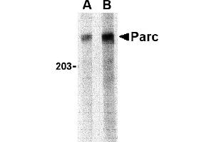Western blot analysis of PARC in Daudi lysate with PARC antibody at (A) 1 and (B) 2 µg/mL.