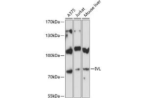 Western blot analysis of extracts of various cell lines, using IVL antibody (ABIN6128143, ABIN6142620, ABIN6142621 and ABIN6224048) at 1:3000 dilution. (Involucrin Antikörper  (AA 416-585))