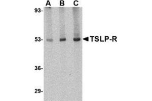 Western blot analysis of TSLP Receptor in human liver tissue lysate with this product at (A) 0.